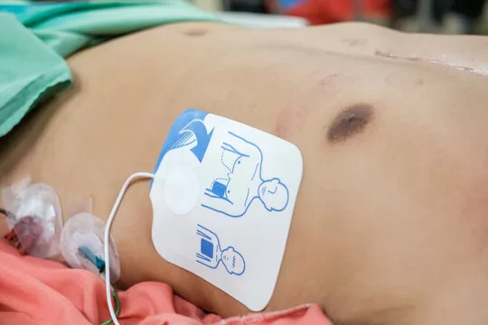 desfibrilador e cardioversor